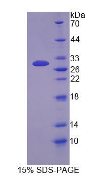 Figure 1. SDS-PAGE