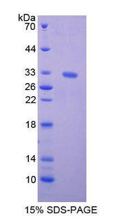 Figure 1. SDS-PAGE