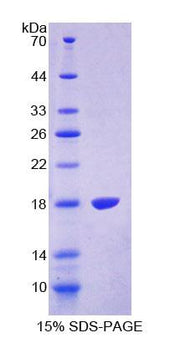 Figure 1. SDS-PAGE