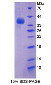 Figure 1. SDS-PAGE