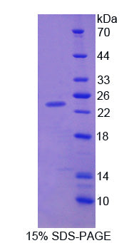 Figure 1. SDS-PAGE