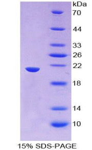 Figure 1. SDS-PAGE