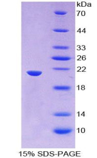 Figure 1. SDS-PAGE