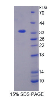 Figure 1. SDS-PAGE