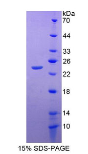 Figure 1. SDS-PAGE