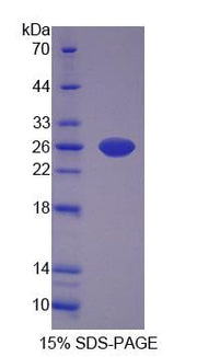 Figure 1. SDS-PAGE