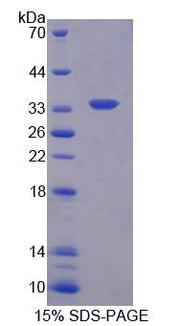 Figure 1. SDS-PAGE