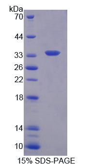 Figure 1. SDS-PAGE