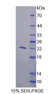 Figure 1. SDS-PAGE