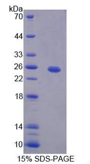 Figure 1. SDS-PAGE