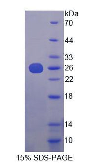 Figure 1. SDS-PAGE