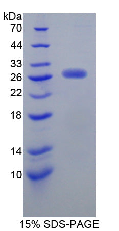 Figure 1. SDS-PAGE