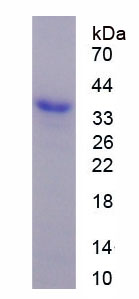 Figure 1. SDS-PAGE