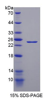 Figure 1. SDS-PAGE