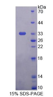 Figure 1. SDS-PAGE