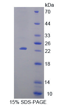 Figure 1. SDS-PAGE