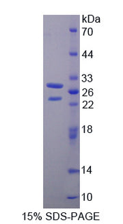 Figure 1. SDS-PAGE