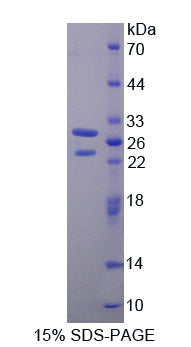 Figure 1. SDS-PAGE