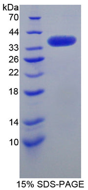 Figure 1. SDS-PAGE