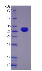 Figure 2. SDS-PAGE
