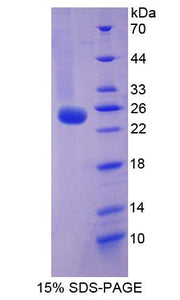 Figure 1. SDS-PAGE