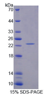 Figure 1. SDS-PAGE