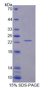 Figure 1. SDS-PAGE