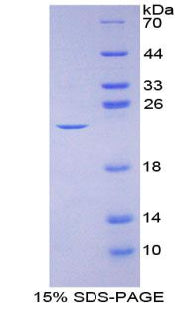 Figure 1. SDS-PAGE