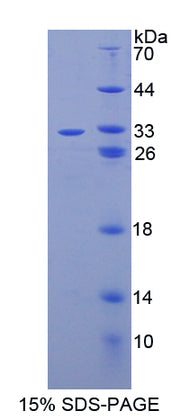 Figure 1. SDS-PAGE