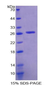Figure 1. SDS-PAGE