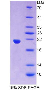 Figure 1. SDS-PAGE