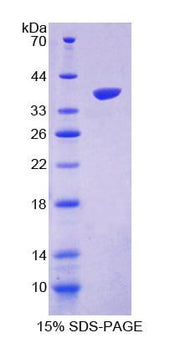 Figure 1. SDS-PAGE