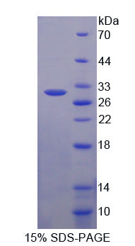 Figure 1. SDS-PAGE