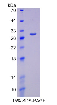 Figure 1. SDS-PAGE