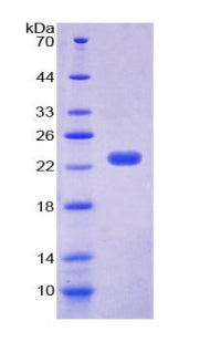 Figure 1. SDS-PAGE