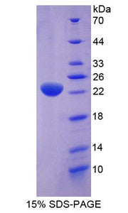 Figure 1. SDS-PAGE