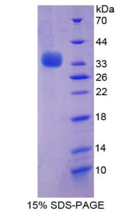 Figure 1. SDS-PAGE