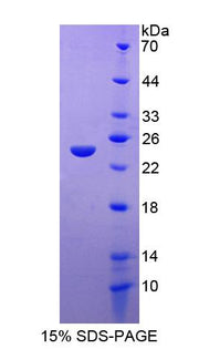 Figure 1. SDS-PAGE
