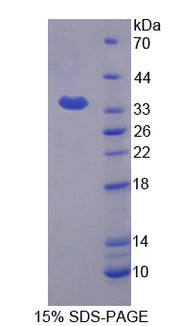 Figure 1. SDS-PAGE