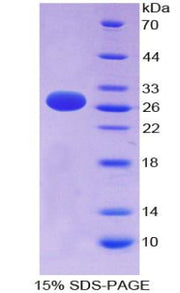 Figure 1. SDS-PAGE