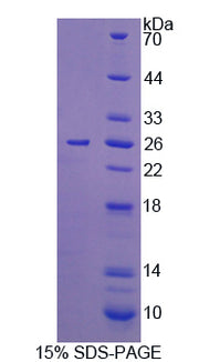 Figure 1. SDS-PAGE