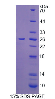 Figure 1. SDS-PAGE