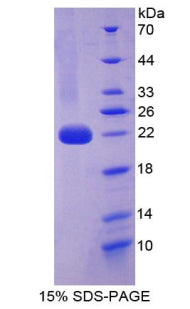 Figure 1. SDS-PAGE