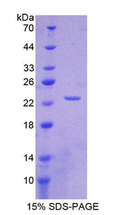 Figure 1. SDS-PAGE