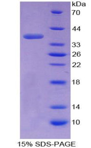 Figure 1. SDS-PAGE