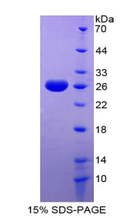Figure 1. SDS-PAGE