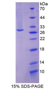 Figure 1. SDS-PAGE