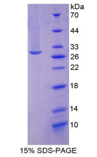 Figure 1. SDS-PAGE