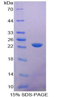 Figure 1. SDS-PAGE