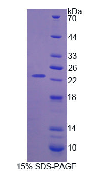 Figure 1. SDS-PAGE